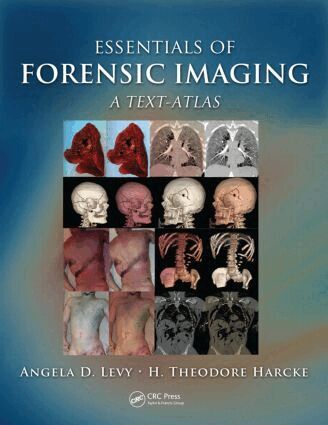 Angela D. Levy, H. Theodore Harcke Jr. - Essentials of Forensic Imaging, Inbunden