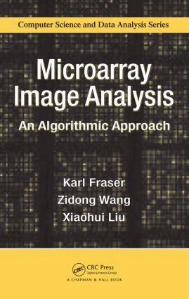 Karl Fraser, Zidong Wang, Xiaohui Liu - Microarray Image Analysis, Inbunden