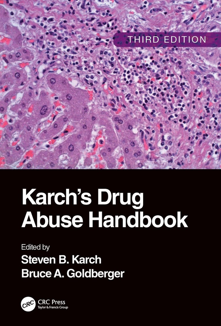 Steven B. Karch, Bruce A. Goldberger, FFFLM Karch, Steven B., MD, USA) Goldberger, Bruce A. (MD, FFFLM, FFSSoc, Consultant Cardiac Pathologist and Toxicologist, Berkeley, California - Karch's Drug Abuse Handbook, Inbunden