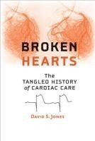David S. Jones, Harvard University) Jones, David S. (A. Bernard Ackerman Professor of the Culture of Medicine, David S Jones - Broken Hearts, Inbunden