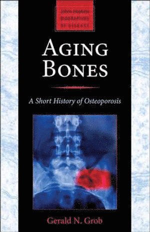 bokomslag Aging Bones