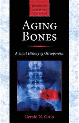 Aging Bones 1