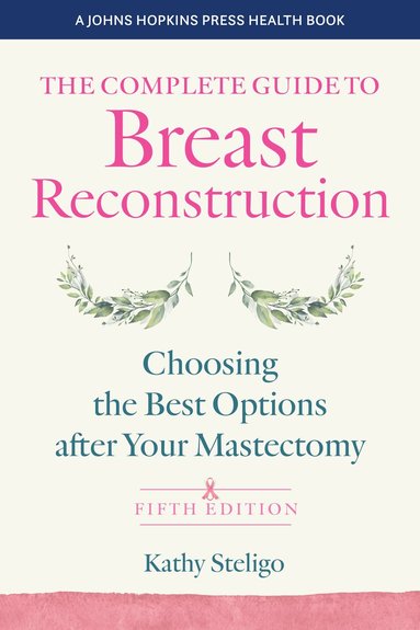 Kathy Steligo - Complete Guide to Breast Reconstruction, Häftad