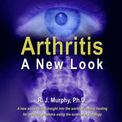 Arthritis-A New Look 1
