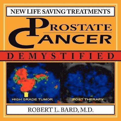 Prostate Cancer Demystified 1