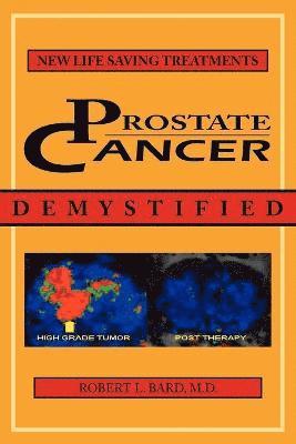 bokomslag Prostate Cancer Demystified