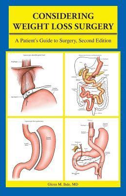 Considering Weight Loss Surgery 1
