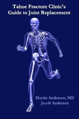 Martin Anderson M.D., Martin Anderson M. D. - Tahoe Fracture Clinic's Guide to Joint Replacement, Häftad