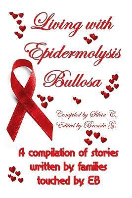 bokomslag Living with Epidermolysis Bullosa