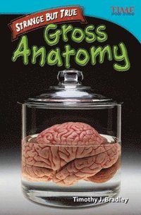 bokomslag Strange but True: Gross Anatomy