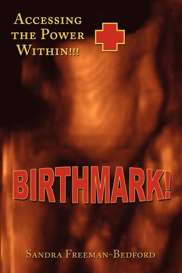 Birthmark! 1