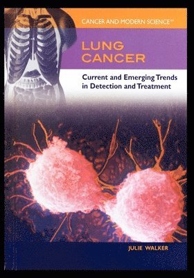 Lung Cancer: Current and Emerging Trends in Detection and Treatment 1