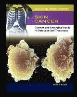 bokomslag Skin Cancer: Current and Emerging Trends in Detection and Treatment