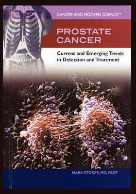 Mark Stokes - Prostate Cancer: Current and Emerging Trends in Detection and Treatment, Häftad