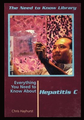 Hepatitis C