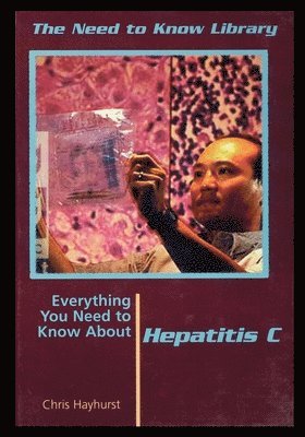 Hepatitis C 1