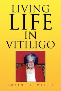 bokomslag Living Life in Vitiligo