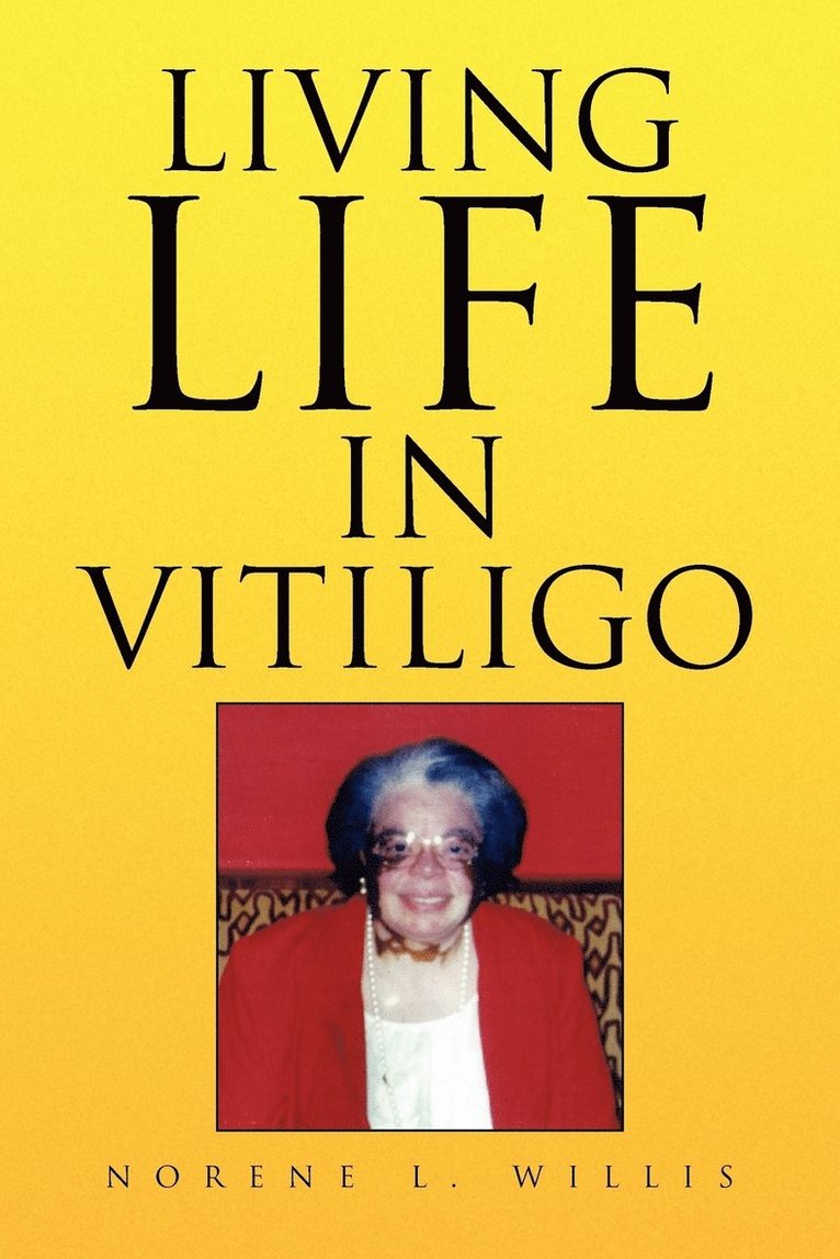 Living Life in Vitiligo 1