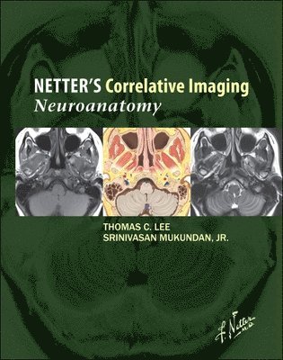 Thomas C. Lee, Srinivasan Mukundan, Massachusetts) Lee, Thomas C. (Assistant Section Head<br>Neuroradiology<br>Instructor<br>Harvard Medical School<br>Boston, Massachusetts) Mukundan, Srinivasan (Neuroradiology Network Chief<br>Brigham and Women's Hospital<br>Associate Professor of Radiology<br>Harvard University<br>Boston, Thomas C Lee - Netter's Correlative Imaging: Neuroanatomy, Inbunden