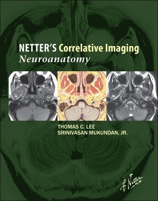 Netter's Correlative Imaging: Neuroanatomy 1