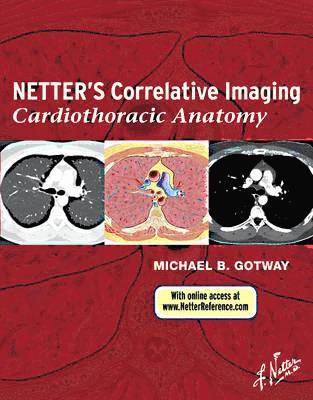 Netter's Correlative Imaging: Cardiothoracic Anatomy 1