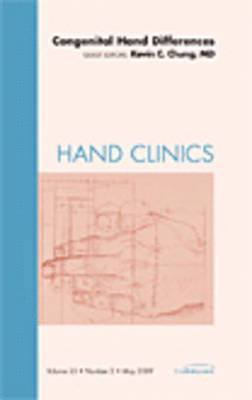 Kevin C. Chung, Kevin C Chung - Congenital Hand Differences, An Issue of Hand Clinics, Inbunden