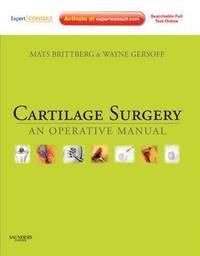 bokomslag Cartilage Surgery