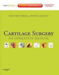 bokomslag Cartilage Surgery: An Operative Manual, Expert Consult: Online and Print
