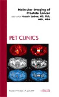bokomslag Molecular Imaging of Prostate Cancer, An Issue of PET Clinics