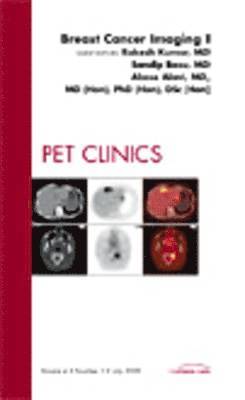 Rakesh Kumar, Sandip Basu, Abass Alavi - Breast Cancer Imaging I, An Issue of PET Clinics, Inbunden
