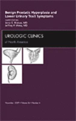 Benign Prostatic Hyperplasia and Lower Urinary Tract Symptoms, An Issue of Urologic Clinics 1