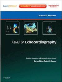 bokomslag Atlas of Echocardiography: Imaging Companion to Braunwald's Heart Disease