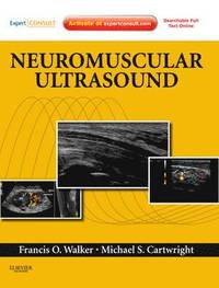 bokomslag Neuromuscular Ultrasound
