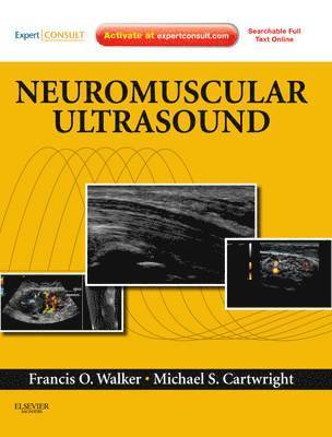 Neuromuscular Ultrasound 1