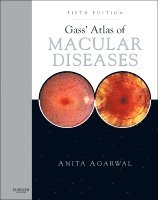 Anita Agarwal - Gass' Atlas of Macular Diseases, Inbunden