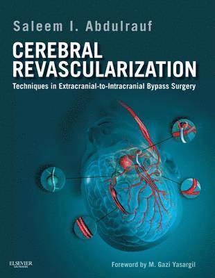 bokomslag Cerebral Revascularization