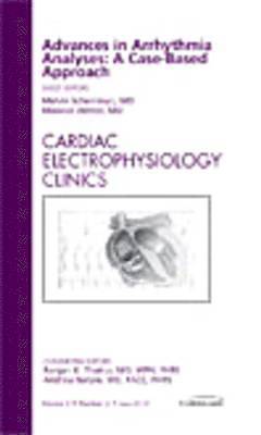 Advances in Arrhythmia Analyses: A Case-Based Approach, An Issue of Cardiac Electrophysiology Clinics 1