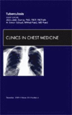 Tuberculosis, An Issue of Clinics in Chest Medicine 1