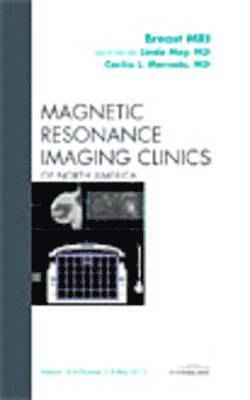 Breast MRI, An Issue of Magnetic Resonance Imaging Clinics 1