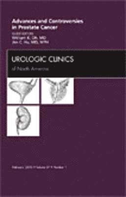 bokomslag Advances and Controversies in Prostate Cancer, An Issue of Urologic Clinics