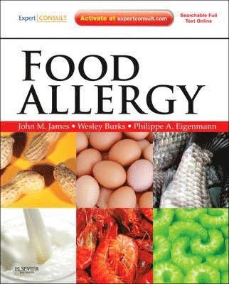 Food Allergy 1