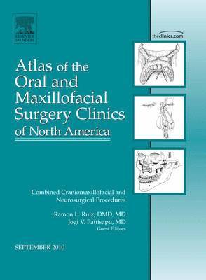 Combined Craniomaxillofacial and Neurosurgical Procedures, An Issue of Atlas of the Oral and Maxillofacial Surgery Clinics 1