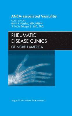 ANCA-Associated Vasculitis, An Issue of Rheumatic Disease Clinics 1