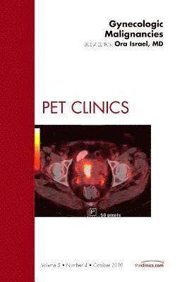 Ora Israel, Israel) Israel, Ora (Department of Nuclear Medicine, Rambam Medical Center, Haifa - Gynecologic Malignancies, An Issue of PET Clinics, Inbunden