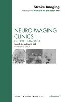 Pamela W. Schaefer, Pamela W Schaefer - Stroke Imaging, An Issue of Neuroimaging Clinics, Inbunden