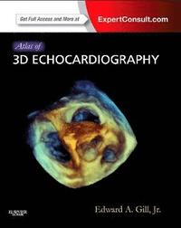 bokomslag Atlas of 3D Echocardiography