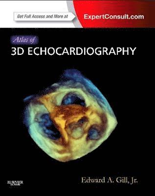 Atlas of 3D Echocardiography 1