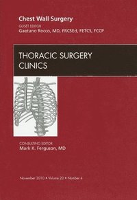 bokomslag Chest Wall Surgery, An Issue of Thoracic Surgery Clinics