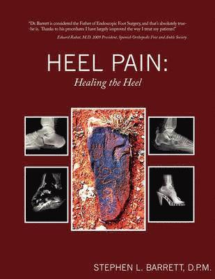 Heel Pain 1