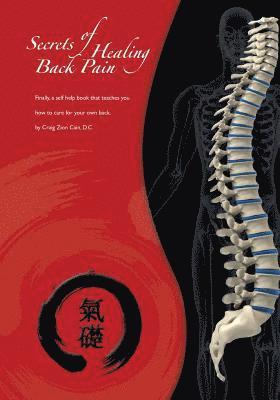 Secrets of Healing Back Pain: Finally, a self help book that teaches YOU how to care for your back! 1